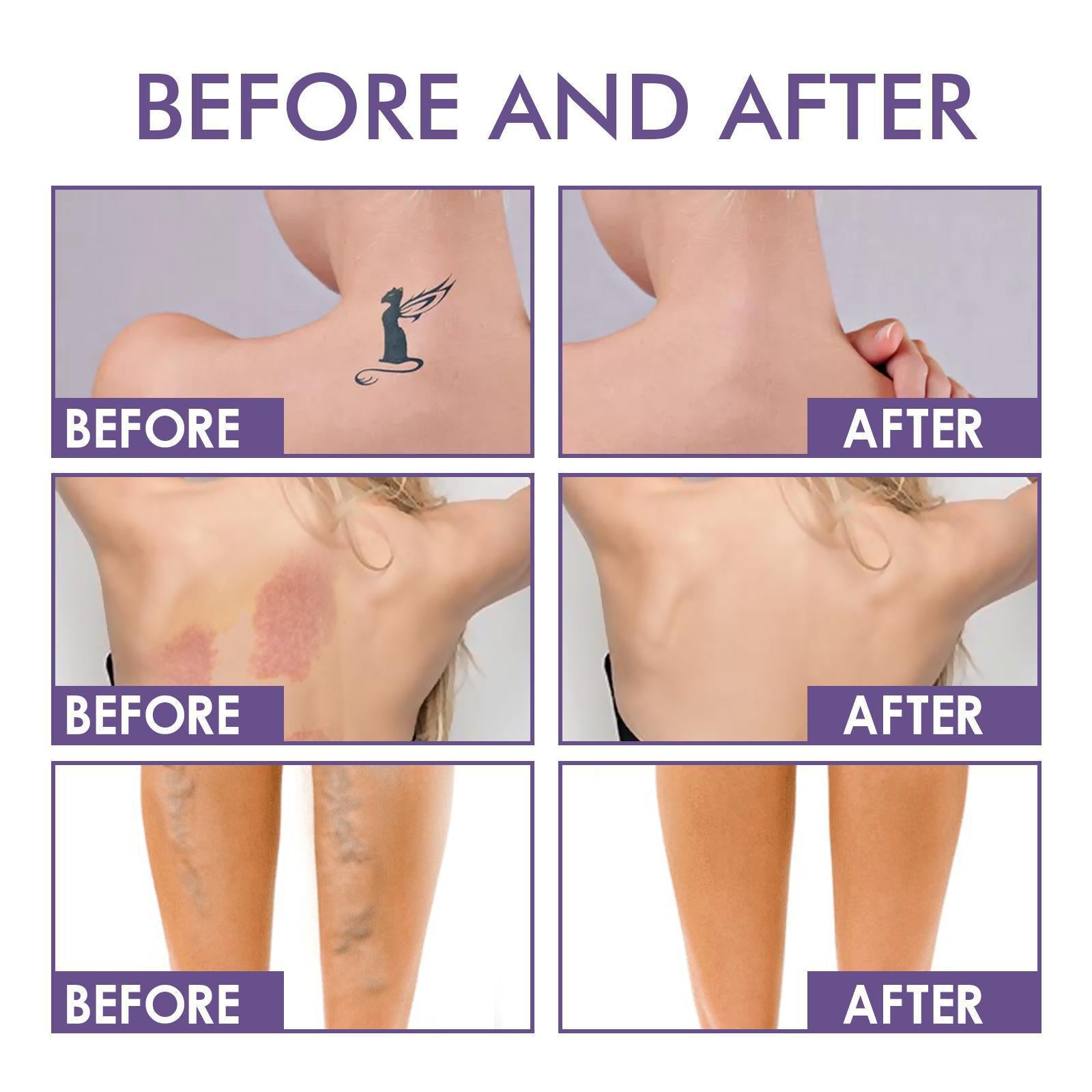 💜✨Body Coverage Perfector – Waterproof, Lightweight & Flawless Body Makeup
